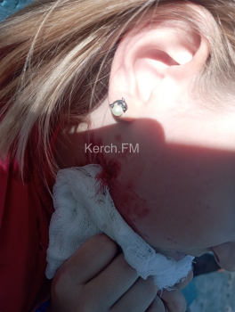 Опасное ограждение: ребенок в Керчи пострадал на новой детской площадке в Капканах