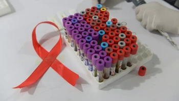 ВИЧ-инфекцию в Крыму стали чаще выявлять у благополучных граждан старше 40 лет